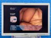 OLYMPUS GIF-XP260 Endoscope