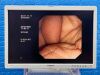 OLYMPUS GIF-XP260 Endoscope