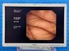 OLYMPUS GIF-XP260 Endoscope