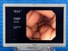 OLYMPUS GIF-XP260 Endoscope