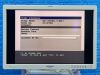 OLYMPUS GIF-XP260 Endoscope