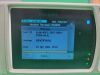 PHILIPS IntelliVue MP2 Patient Monitor