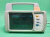 PHILIPS IntelliVue MP2 Patient Monitor