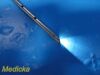PILLING 6X  Assorted Holinger 6X Pilling Assorted Holinger Bronchoscopes