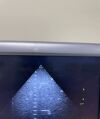 TOSHIBA New ultrasonic probe Ultrasound probe, transducer Ultrasound Accessories