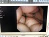 OLYMPUS VISERA ELITE OTV-S190, CLV-S190 Endoscopy Processor