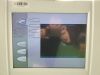ZEISS MediLive  MindStream O/R Camera