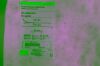 COOK G04035 Double Lumen Central Venous Catheter Set and Tray, 4 Fr Size, 8 cm Catheter Length