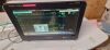 PHILIPS MX700 ICU/CCU