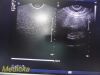 PHILIPS C9-5ec Ref 453561232031 Endocavity Ultrasound Transducer