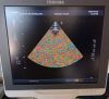 TOSHIBA PST-50AT Ultrasound Transducer