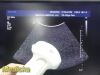 PHILIPS C5-1 Broadband Curved Array Ultrasound Transducer
