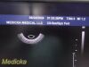 PHILIPS C9-5ec Ref 453561232031 Endocavity Ultrasound Transducer