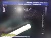 PHILIPS C9-5ec Ref 453561232031 Endocavity Ultrasound Transducer