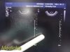 PHILIPS C9-5ec Ref 453561232031 Endocavity Ultrasound Transducer