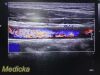 PHILIPS L12-5 Linear Array Ultrasound Transducer