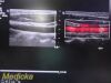 PHILIPS L12-5 Linear Array Ultrasound Transducer