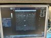 GE I739-RS Ultrasound Transducer