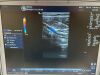 GE I739-RS Ultrasound Transducer