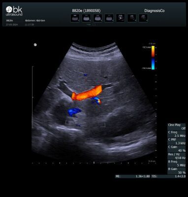 BK MEDICAL 8820e Ultrasound Transducer