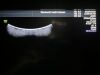 GE E10 2016 GE E10 Ultrasound