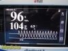 MASIMO 2012  Radical 7 Rainbow  , W/ Dock & Reusable Sensor ~ Oximeter - Pulse