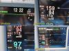 NIHON KOHDEN 2007  Model BSM-2354A-S-M Patient Monitor
