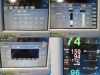NIHON KOHDEN 2007  Model BSM-2354A-S-M Patient Monitor