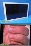 D&TC Inc Foreseeson FS-L2601D HDTV Surgical Monitor