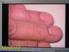 D&TC Inc Foreseeson FS-L2601D HDTV Surgical Monitor