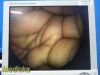 CABOT MEDICAL 10mm x 10° Rigid Telescope Ref 004873-901; Laparoscope