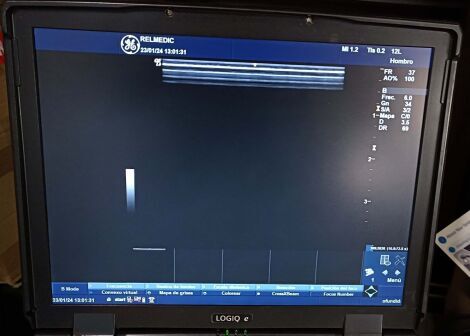 GE 12L-RS Ultrasound Transducer