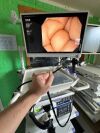 OLYMPUS CV-190 Endoscopy Processor