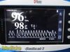 MASIMO 2012  Radical 7 Rainbow , W/ Dock & Reusable Sensor ~ Oximeter - Pulse