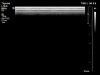 PHILIPS L18-5 Ultrasound Transducer