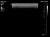 PHILIPS L12-5 Ultrasound Transducer