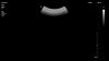 PHILIPS C9-2 Ultrasound Transducer