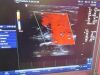 GE Portable Ultrasound Machine w/ Probe & Docking LogiqE Portable Ultrasound System w/ 12L-RS Probe   Docking Cart Logiq E DVD