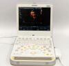 PHILIPS  CX50 DIAGNOSTIC ULTRASOUND SYSTEM WITH S5-1 AND D2CWC PROBES - REV 3.1.1