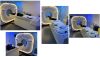 PHILIPS Healthcare / Vereos PET/CT PET/CT