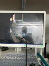 OLYMPUS BF-P180 Bronchoscope