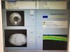 ZEISS Cirrus 5000 HD Optical Coherence Tomography (OCT)