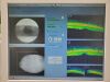 ZEISS Cirrus 5000 HD Optical Coherence Tomography (OCT)