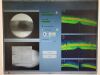 ZEISS Cirrus 5000 HD Optical Coherence Tomography (OCT)