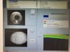 ZEISS Cirrus 5000 HD Optical Coherence Tomography (OCT)