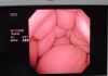 OLYMPUS CYF-V2R Cystoscope