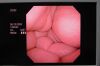 OLYMPUS CYF-V2R Cystoscope