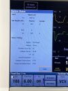 GE DATEX-OHMEDA Aisys CS2, YOM: 2014 Anesthesia Machine
