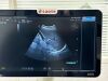 ESAOTE MYLAB SEVEN Ultrasound - OB / GYN