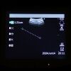 OLYMPUS EVIS BF-UC160F-0L8 Ultrasonic with EU-C60 Ultrasound Center Bronchoscope